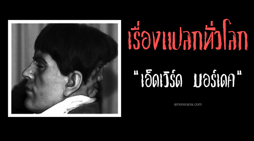 เอ็ดเวิร์ด มอร์เดค (Edward Mordake) ชายสองหน้า ประเทศอังกฤษ